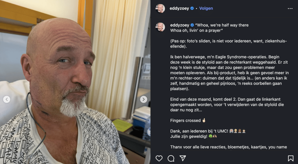 Eddy Zoey Update Operatie