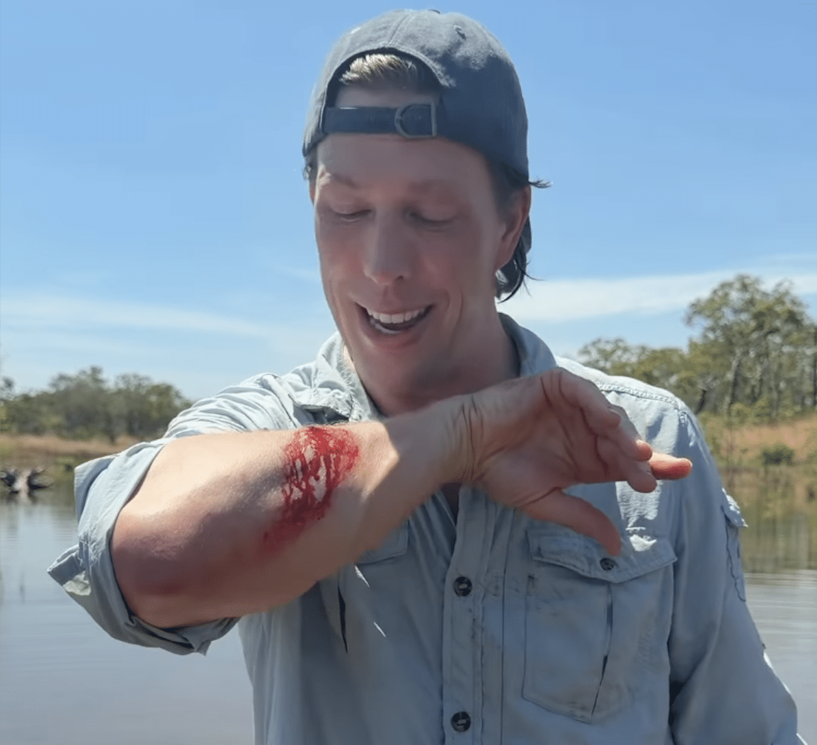 Freek Vonk Gebeten Door Krokodil